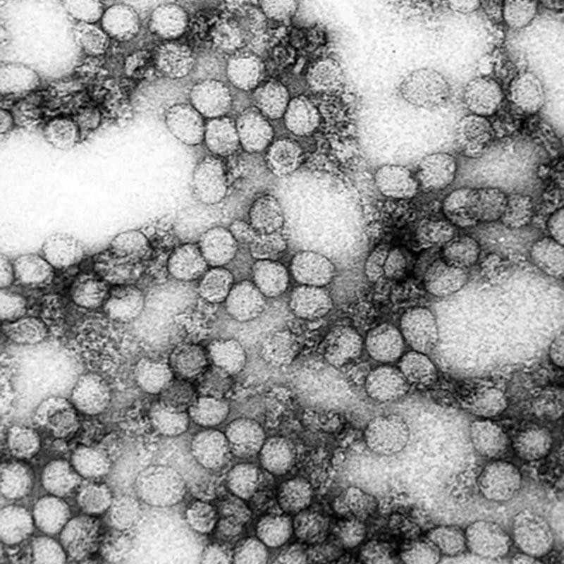 Charleston's long history of quarantining